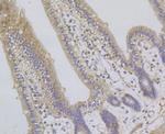 GABARAPL2 Antibody in Immunohistochemistry (Paraffin) (IHC (P))