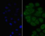 BCL6 Antibody in Immunocytochemistry (ICC/IF)