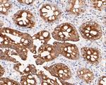 Cytokeratin 20 Antibody in Immunohistochemistry (Paraffin) (IHC (P))