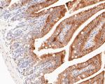 Cytokeratin 20 Antibody in Immunohistochemistry (Paraffin) (IHC (P))