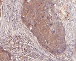 delta Catenin Antibody in Immunohistochemistry (Paraffin) (IHC (P))