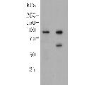 delta Catenin Antibody in Western Blot (WB)