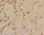 B3GAT1 Antibody in Immunohistochemistry (Paraffin) (IHC (P))