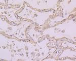 Folate Receptor alpha Antibody in Immunohistochemistry (Paraffin) (IHC (P))