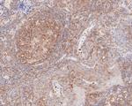 Cytokeratin 20 Antibody in Immunohistochemistry (Paraffin) (IHC (P))