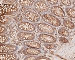 Cytokeratin 20 Antibody in Immunohistochemistry (Paraffin) (IHC (P))