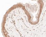 Cytokeratin 20 Antibody in Immunohistochemistry (Paraffin) (IHC (P))