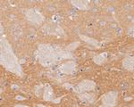 DPP6 Antibody in Immunohistochemistry (Paraffin) (IHC (P))