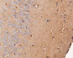 DPP6 Antibody in Immunohistochemistry (Paraffin) (IHC (P))