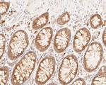 MUC1 Antibody in Immunohistochemistry (Paraffin) (IHC (P))