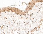 MUC1 Antibody in Immunohistochemistry (Paraffin) (IHC (P))