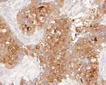 MUC1 Antibody in Immunohistochemistry (Paraffin) (IHC (P))