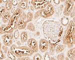 MUC1 Antibody in Immunohistochemistry (Paraffin) (IHC (P))