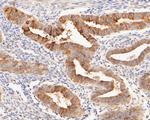 MUC1 Antibody in Immunohistochemistry (Paraffin) (IHC (P))