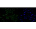 MDM2 Antibody in Immunocytochemistry (ICC/IF)