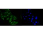 MDM2 Antibody in Immunocytochemistry (ICC/IF)