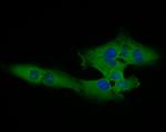 Cardiac Troponin C Antibody in Immunocytochemistry (ICC/IF)