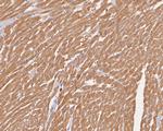 Cardiac Troponin C Antibody in Immunohistochemistry (Paraffin) (IHC (P))