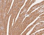 Cardiac Troponin C Antibody in Immunohistochemistry (Paraffin) (IHC (P))