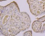 CLIC4 Antibody in Immunohistochemistry (Paraffin) (IHC (P))