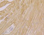 CLIC4 Antibody in Immunohistochemistry (Paraffin) (IHC (P))