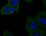 KV1.4 (KCNA4) Antibody in Immunocytochemistry (ICC/IF)