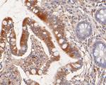 Nhe-1 Antibody in Immunohistochemistry (Paraffin) (IHC (P))