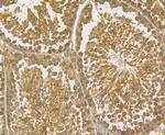 TRF2 Antibody in Immunohistochemistry (Paraffin) (IHC (P))