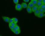 CDK5RAP3 Antibody in Immunocytochemistry (ICC/IF)