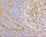 Thymidine Phosphorylase Antibody in Immunohistochemistry (Paraffin) (IHC (P))