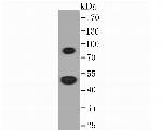 Thymidine Phosphorylase Antibody in Western Blot (WB)