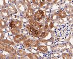 Rab11 FIB3 Antibody in Immunohistochemistry (Paraffin) (IHC (P))