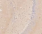 GABRA5 Antibody in Immunohistochemistry (Paraffin) (IHC (P))