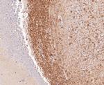 BIN1 Antibody in Immunohistochemistry (Paraffin) (IHC (P))