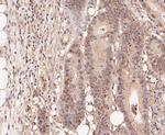 BIN1 Antibody in Immunohistochemistry (Paraffin) (IHC (P))