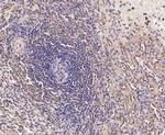 BIN1 Antibody in Immunohistochemistry (Paraffin) (IHC (P))