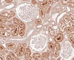 BIN1 Antibody in Immunohistochemistry (Paraffin) (IHC (P))