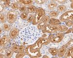 Aldolase B Antibody in Immunohistochemistry (Paraffin) (IHC (P))