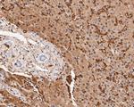 Aldolase B Antibody in Immunohistochemistry (Paraffin) (IHC (P))