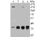 Aldolase B Antibody in Western Blot (WB)