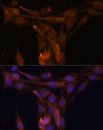 Caspase 9 Antibody in Immunocytochemistry (ICC/IF)