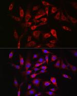 SOCS3 Antibody in Immunocytochemistry (ICC/IF)