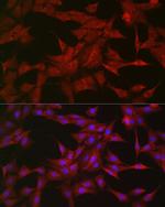 SOCS3 Antibody in Immunocytochemistry (ICC/IF)