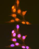 PCBP1 Antibody in Immunocytochemistry (ICC/IF)