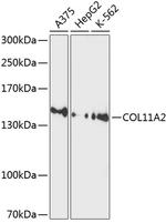 COL11A2 Antibody in Western Blot (WB)