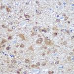 HuD Antibody in Immunohistochemistry (Paraffin) (IHC (P))