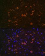 HuD Antibody in Immunohistochemistry (Paraffin) (IHC (P))