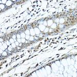 SIRT1 Antibody in Immunohistochemistry (Paraffin) (IHC (P))