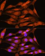 Bcl-3 Antibody in Immunocytochemistry (ICC/IF)