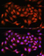 Bcl-3 Antibody in Immunocytochemistry (ICC/IF)